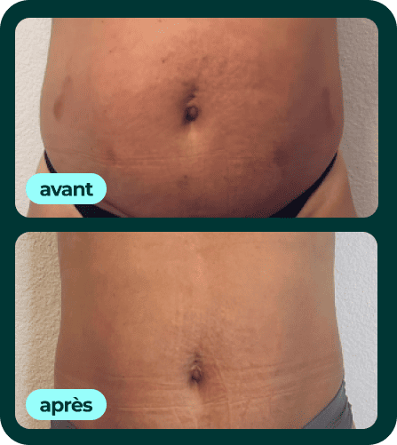 Transformation 01