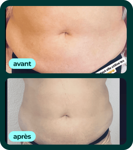 Transformation 2