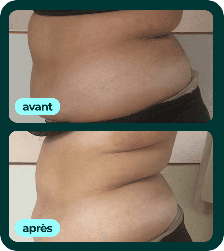 Transformation 3